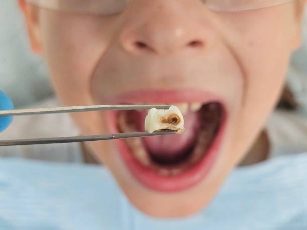 Best Emergency Pediatric Dental Care in Stratford Downtown, CT